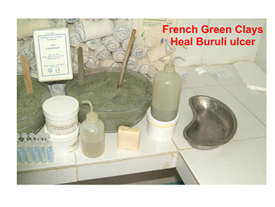 French missionary philanthropist, Ivory Coast, healing clay, buruli ulcer cure, line de courssou